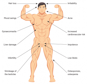 Consequences of steroid use including hair loss, acne, etc.